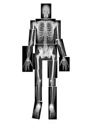 x-ray skeleton activity